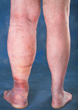Vascular Specialist at Salem Skin and Vein Specialists Continues to...